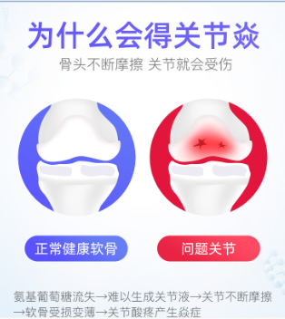氨糖买什么牌子的效果好呢？ 
