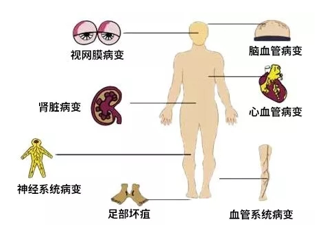 并发症.png 并发症.png