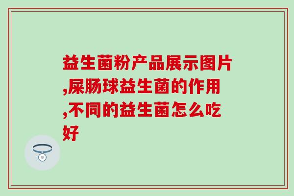 奶粉有没有必要加益生菌(加益生菌的奶粉是否有必要？)