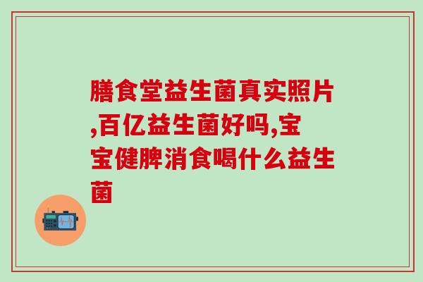 孕妇益生菌菌株选择方法(如何选择适合孕妇的益生菌菌种) 孕妇益生菌菌株选择方法(如何选择适合孕妇的益生菌菌种)