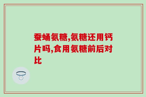 五十岁要吃乐力钙还是氨糖(五十岁以上人群该如何选择补钙方式?乐力钙或氨糖更适合?) 五十岁要吃乐力钙还是氨糖(五十岁以上人群该如何选择补钙方式?乐力钙或氨糖更适合?)