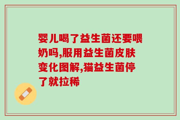 如何选择益生菌成人(如何挑选合适的成人益生菌——专家推荐)