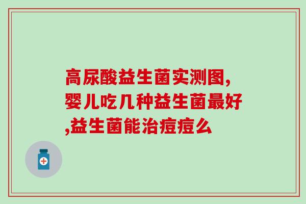 宝通乐益生菌在哪里买(宝通乐益生菌在哪儿购买？)