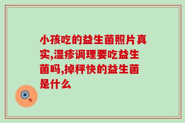 益生菌去火不伤胃吗(益生菌：平衡体内火气，呵护胃肠健康)