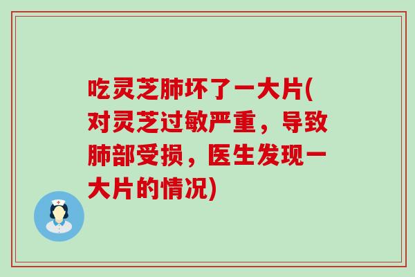 吃灵芝肺坏了一大片(对灵芝过敏严重，导致肺部受损，医生发现一大片的情况)