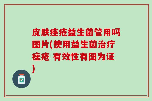 皮肤痤疮益生菌管用吗图片(使用益生菌治疗痤疮 有效性有图为证)