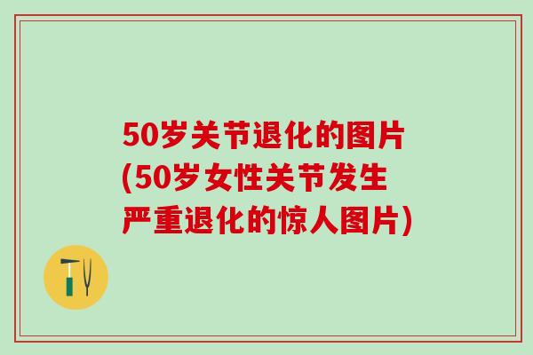 50岁关节退化的图片(50岁女性关节发生严重退化的惊人图片)