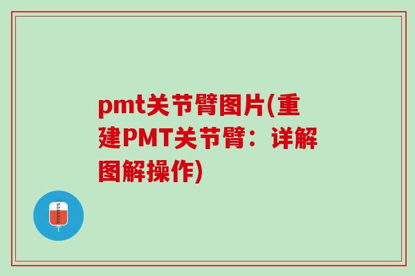 pmt关节臂图片(重建PMT关节臂：详解图解操作)