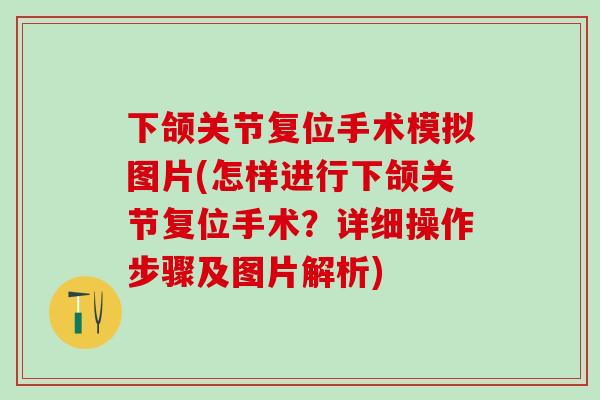 下颌关节复位手术模拟图片(怎样进行下颌关节复位手术？详细操作步骤及图片解析)