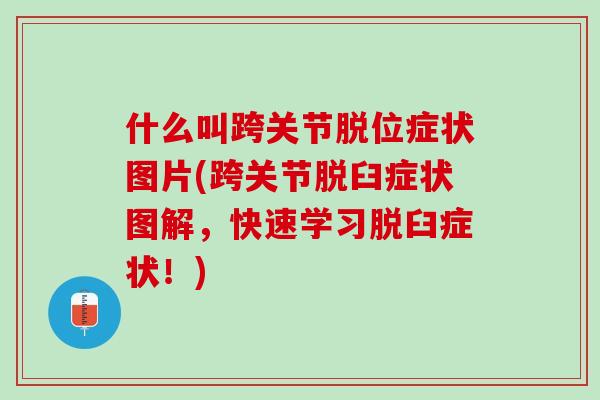 什么叫跨关节脱位症状图片(跨关节脱臼症状图解，快速学习脱臼症状！)