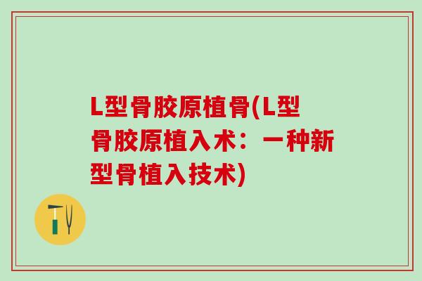 L型骨胶原植骨(L型骨胶原植入术：一种新型骨植入技术)