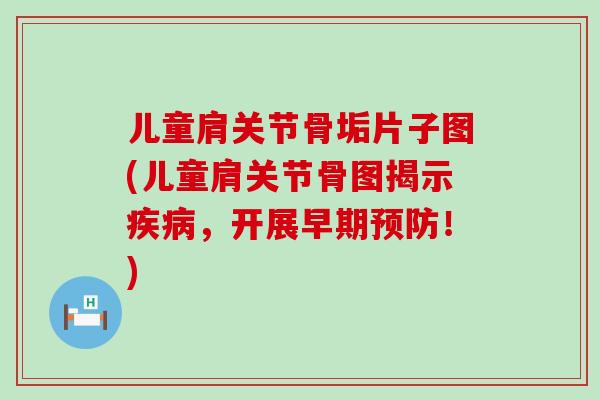儿童肩关节骨垢片子图(儿童肩关节骨图揭示疾病，开展早期预防！)