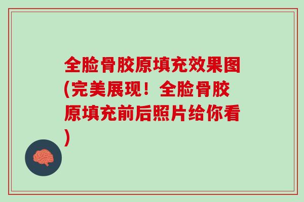全脸骨胶原填充效果图(完美展现！全脸骨胶原填充前后照片给你看)