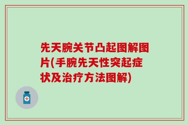 先天腕关节凸起图解图片(手腕先天性突起症状及治疗方法图解)