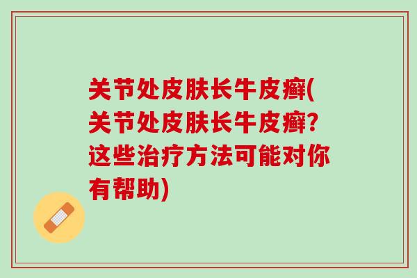 关节处皮肤长牛皮癣(关节处皮肤长牛皮癣？这些治疗方法可能对你有帮助)
