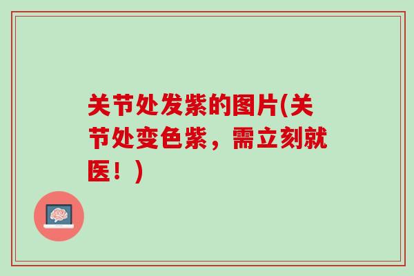 关节处发紫的图片(关节处变色紫,需立刻就医!) 关节处发紫的图片(关节处变色紫,需立刻就医!)