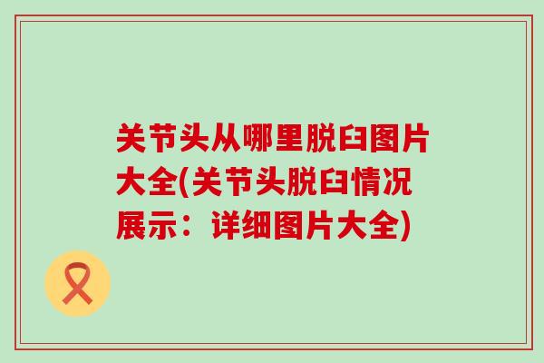 关节头从哪里脱臼图片大全(关节头脱臼情况展示：详细图片大全)