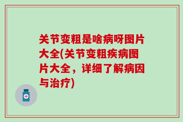 关节变粗是啥病呀图片大全(关节变粗疾病图片大全，详细了解病因与治疗)
