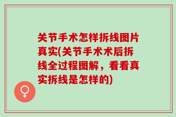 关节手术怎样拆线图片真实(关节手术术后拆线全过程图解，看看真实拆线是怎样的)