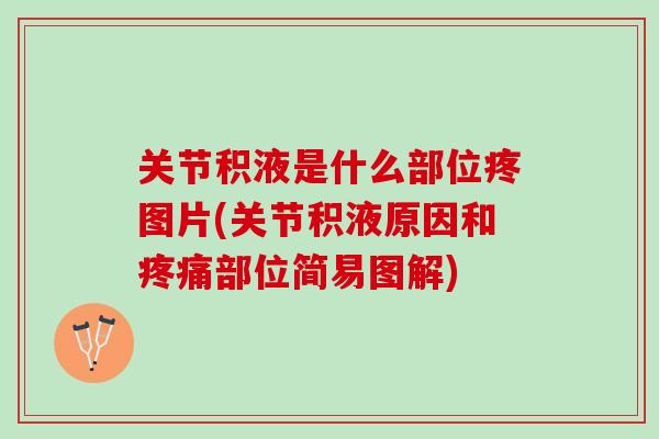 关节积液是什么部位疼图片(关节积液原因和疼痛部位简易图解)