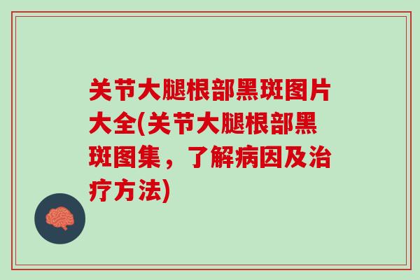 关节大腿根部黑斑图片大全(关节大腿根部黑斑图集，了解病因及治疗方法)