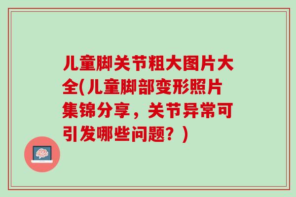 儿童脚关节粗大图片大全(儿童脚部变形照片集锦分享，关节异常可引发哪些问题？)