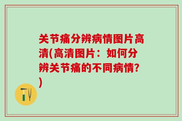 关节痛分辨病情图片高清(高清图片：如何分辨关节痛的不同病情？)