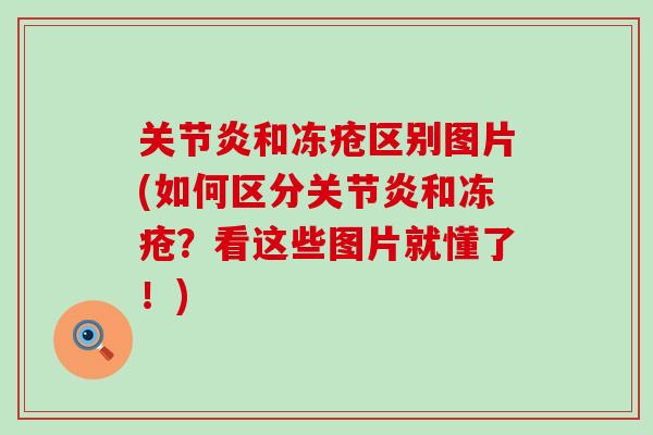 关节炎和冻疮区别图片(如何区分关节炎和冻疮？看这些图片就懂了！)