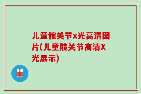 儿童髋关节x光高清图片(儿童髋关节高清X光展示)