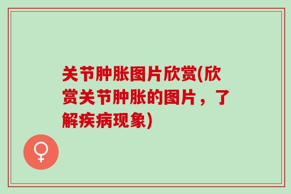 关节肿胀图片欣赏(欣赏关节肿胀的图片，了解疾病现象)