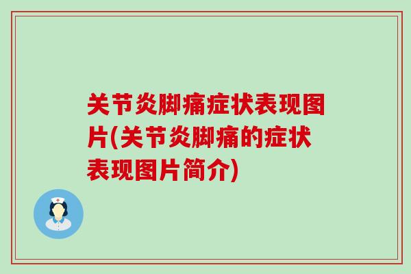 关节炎脚痛症状表现图片(关节炎脚痛的症状表现图片简介)