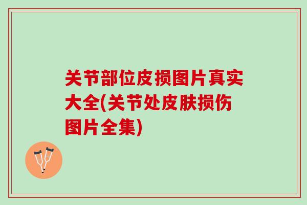 关节部位皮损图片真实大全(关节处皮肤损伤图片全集)