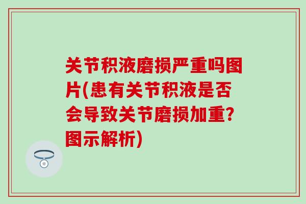 关节积液磨损严重吗图片(患有关节积液是否会导致关节磨损加重？图示解析)