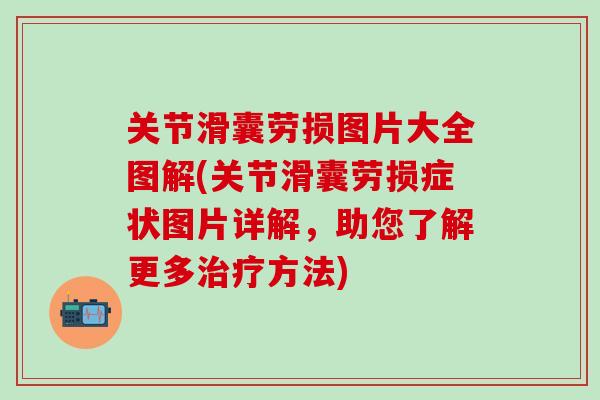关节滑囊劳损图片大全图解(关节滑囊劳损症状图片详解，助您了解更多治疗方法)