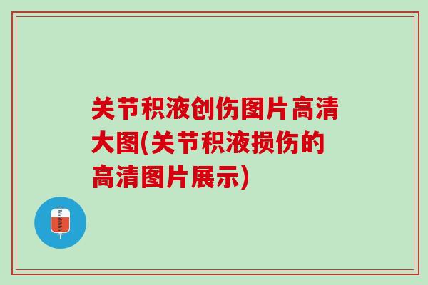 关节积液创伤图片高清大图(关节积液损伤的高清图片展示)