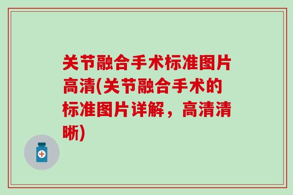 关节融合手术标准图片高清(关节融合手术的标准图片详解，高清清晰)
