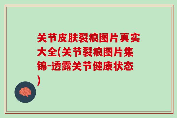 关节裂痕图片真实大全(关节裂痕图片集锦-透露关节健康状态) 关节裂痕图片真实大全(关节裂痕图片集锦-透露关节健康状态)