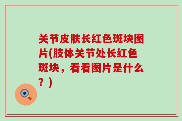 关节皮肤长红色斑块图片(肢体关节处长红色斑块，看看图片是什么？)
