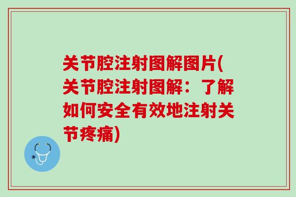 关节腔注射图解图片(关节腔注射图解：了解如何安全有效地注射关节疼痛)