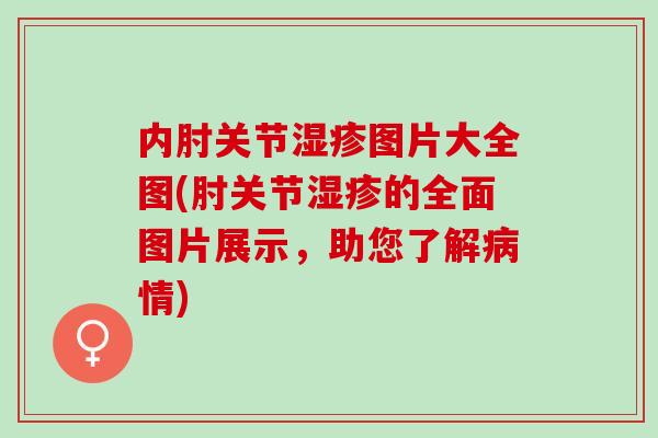 内肘关节湿疹图片大全图(肘关节湿疹的全面图片展示，助您了解病情)