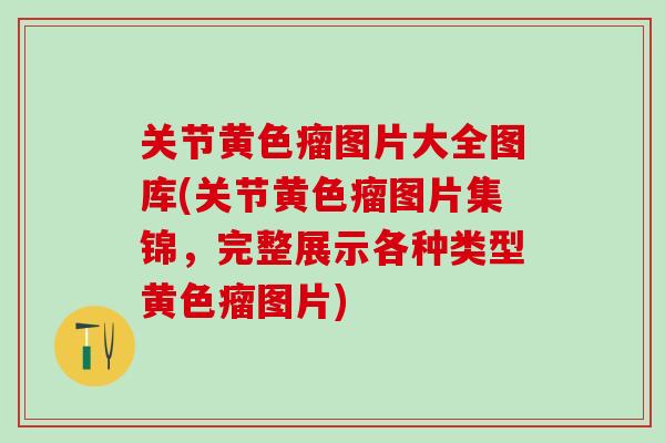关节黄色瘤图片大全图库(关节黄色瘤图片集锦，完整展示各种类型黄色瘤图片)