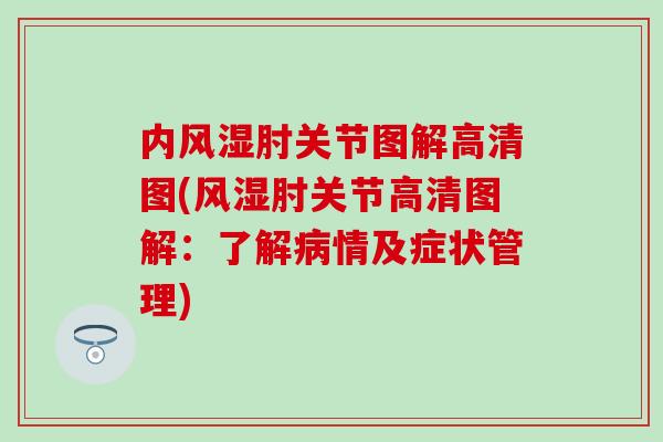 内风湿肘关节图解高清图(风湿肘关节高清图解：了解病情及症状管理)