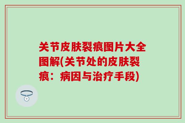 关节皮肤裂痕图片大全图解(关节处的皮肤裂痕：病因与治疗手段)