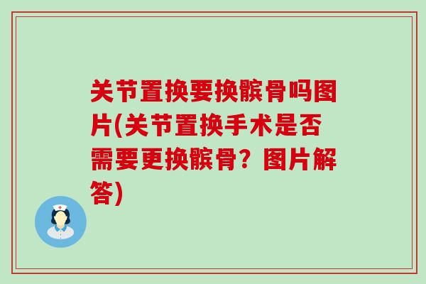 关节置换要换髌骨吗图片(关节置换手术是否需要更换髌骨？图片解答)