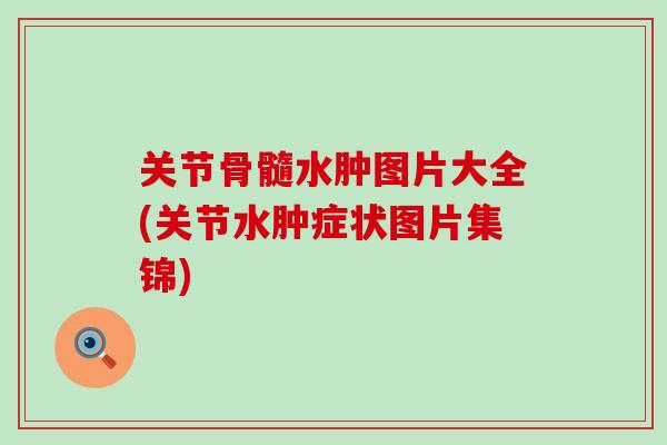 关节骨髓水肿图片大全(关节水肿症状图片集锦)