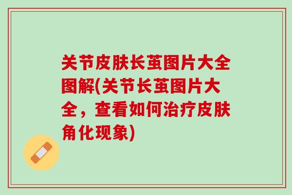 关节皮肤长茧图片大全图解(关节长茧图片大全，查看如何治疗皮肤角化现象)