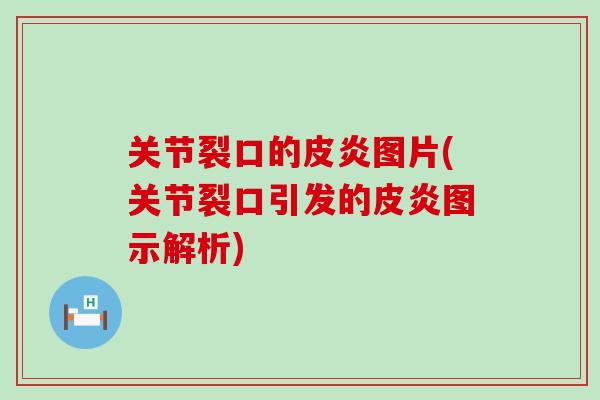 关节裂口的皮炎图片(关节裂口引发的皮炎图示解析)