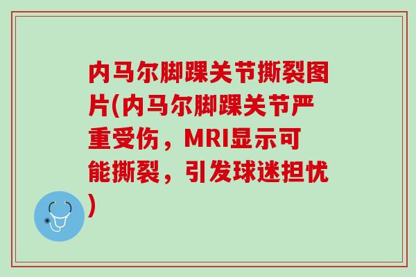内马尔脚踝关节撕裂图片(内马尔脚踝关节严重受伤，MRI显示可能撕裂，引发球迷担忧)
