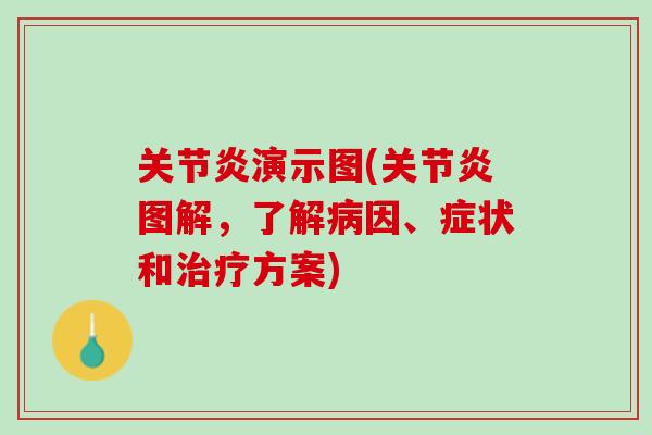 关节炎演示图(关节炎图解，了解病因、症状和治疗方案)