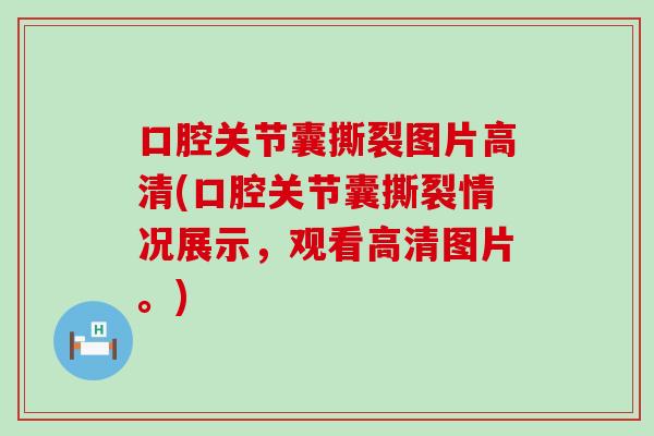 口腔关节囊撕裂图片高清(口腔关节囊撕裂情况展示，观看高清图片。)